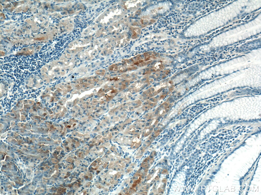 Immunohistochemistry (IHC) staining of human stomach tissue using VANGL2 Polyclonal antibody (21492-1-AP)