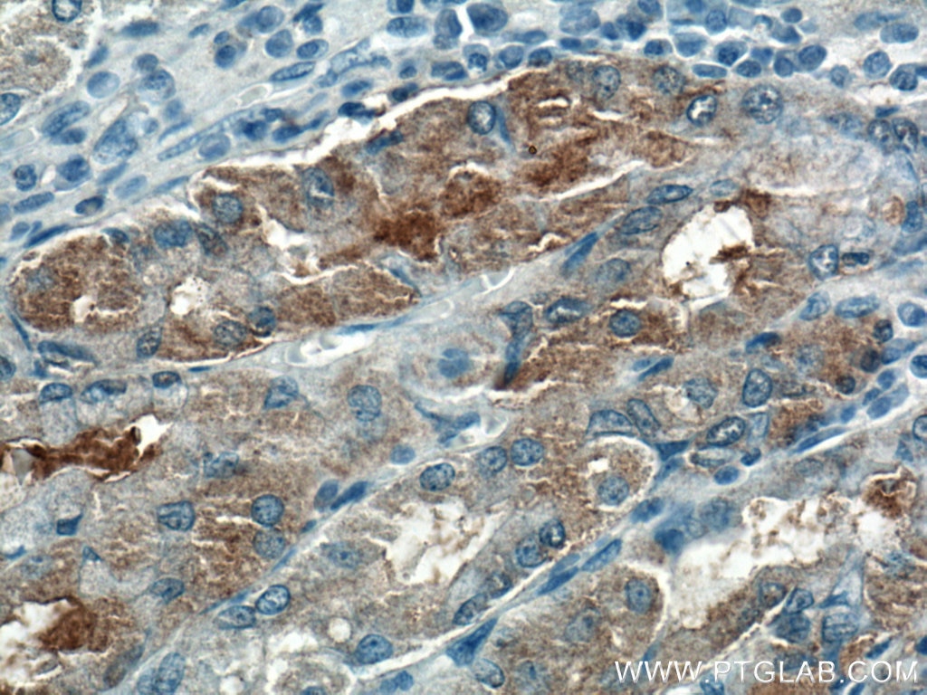 Immunohistochemistry (IHC) staining of human stomach tissue using VANGL2 Polyclonal antibody (21492-1-AP)