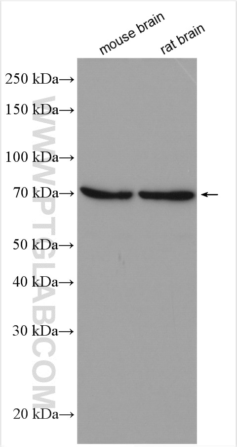Western Blot (WB) analysis of various lysates using VANGL2 Polyclonal antibody (21492-1-AP)