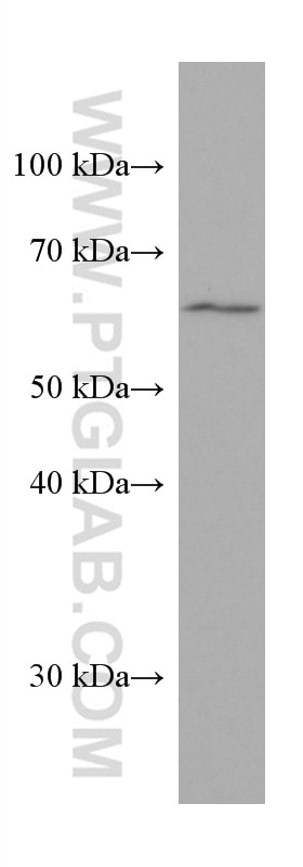 Western Blot (WB) analysis of HeLa cells using VANGL2 Monoclonal antibody (67273-1-Ig)
