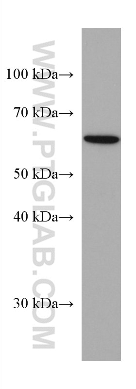 WB analysis of MCF-7 using 67273-1-Ig