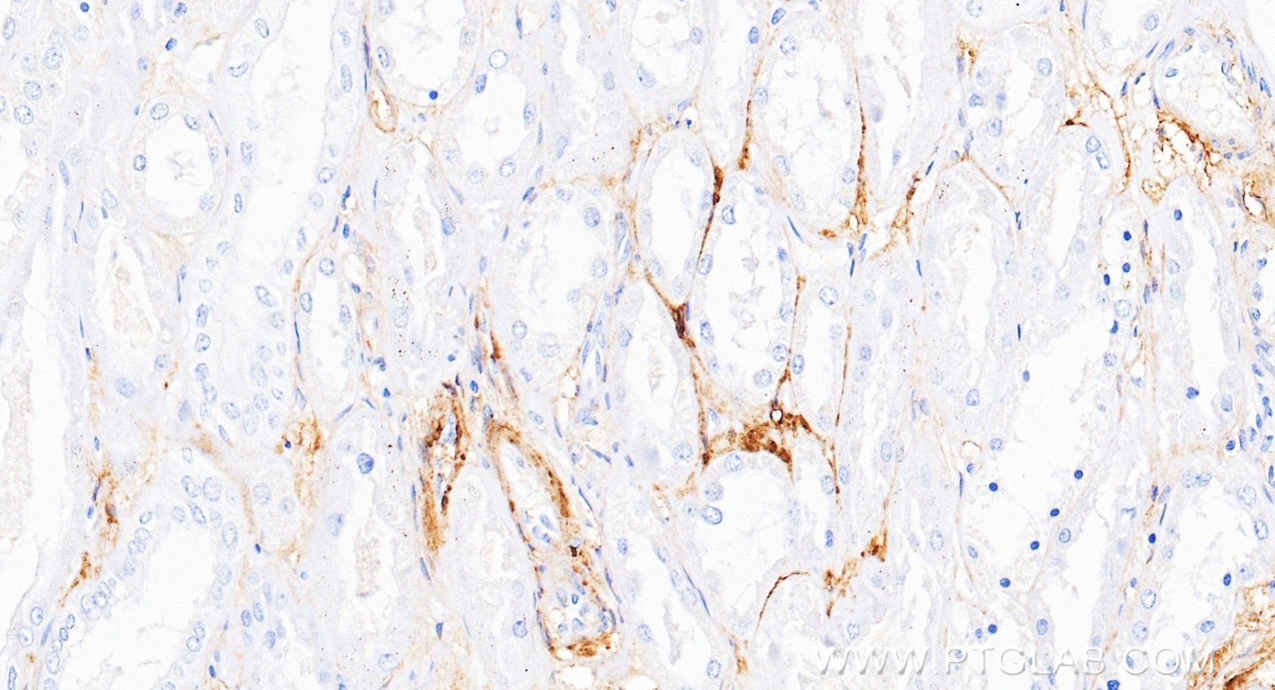 IHC staining of human kidney using 87278-3-RR Immunohistochemistry (IHC) staining of human kidney tissue using VAP1/AOC3 Recombinant monoclonal antibody (87278-3-RR)