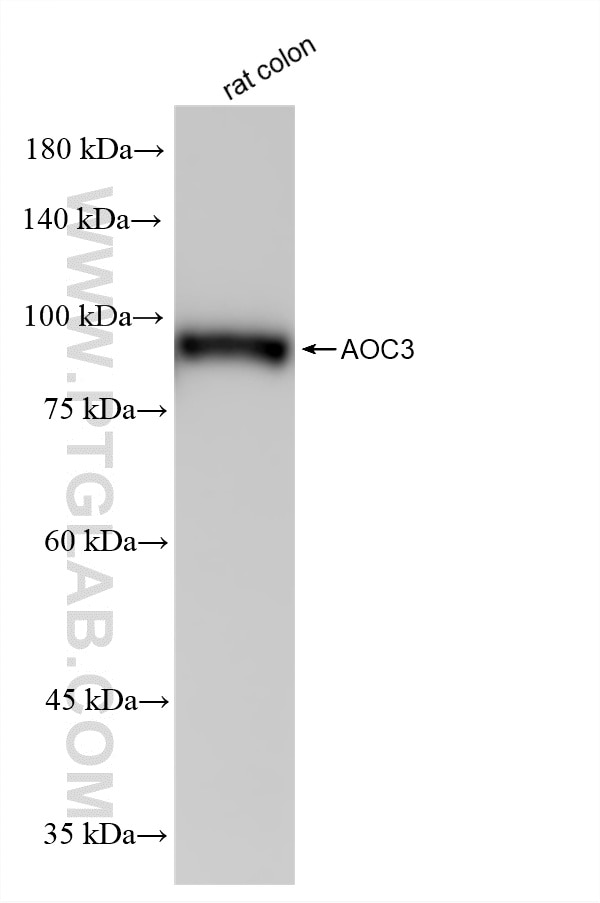 WB analysis using 87278-3-RR Western Blot (WB) analysis of various lysates using VAP1/AOC3 Recombinant monoclonal antibody (87278-3-RR)