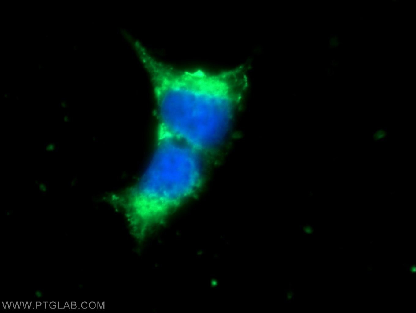 Immunofluorescence (IF) / fluorescent staining of HEK-293 cells using VAPA Polyclonal antibody (15275-1-AP)