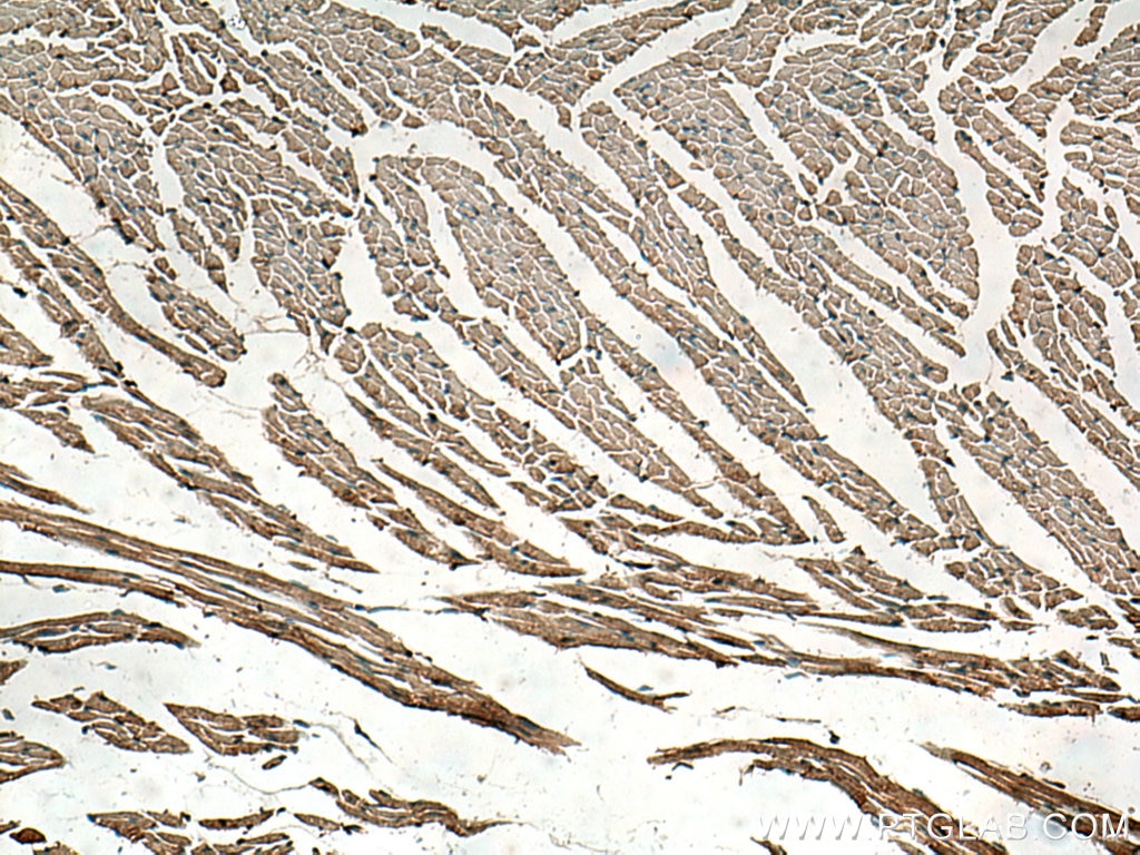 Immunohistochemistry (IHC) staining of mouse heart tissue using VAPA Polyclonal antibody (15275-1-AP)