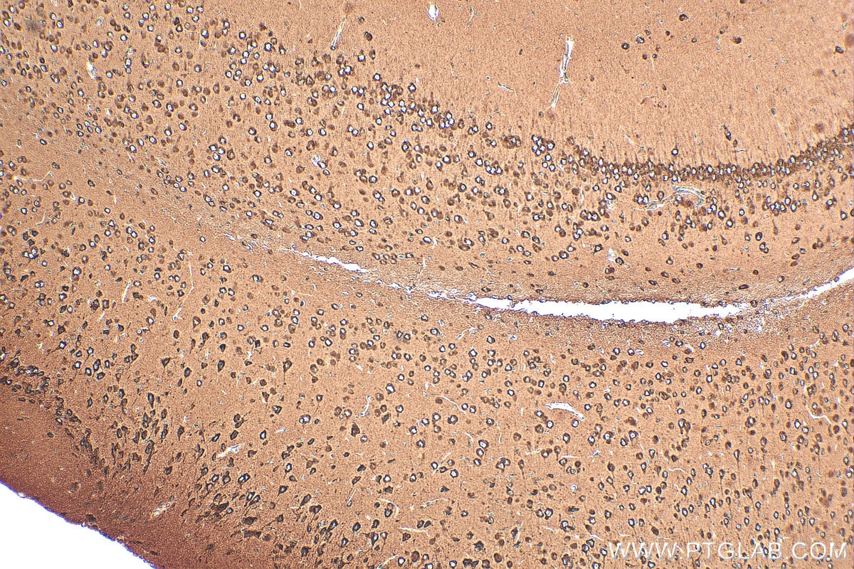 Immunohistochemistry (IHC) staining of mouse brain tissue using VAPA Polyclonal antibody (15275-1-AP)