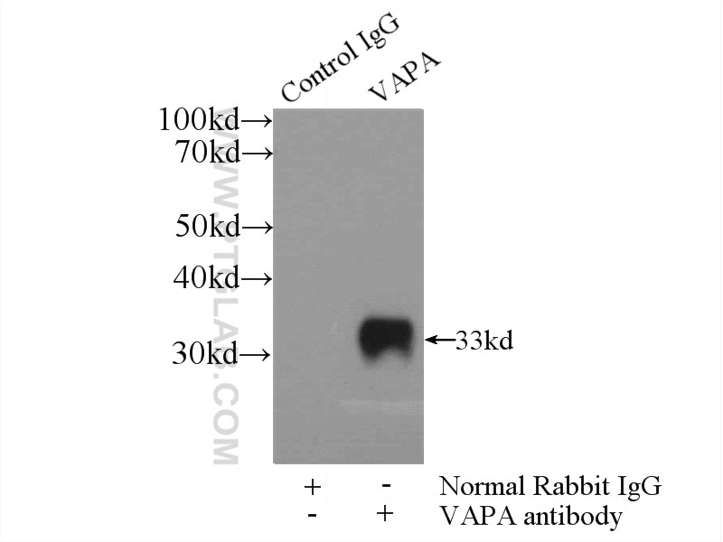 Immunoprecipitation (IP) experiment of HEK-293 cells using VAPA Polyclonal antibody (15275-1-AP)