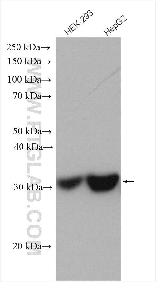 Western Blot (WB) analysis of various lysates using VAPA Polyclonal antibody (15275-1-AP)