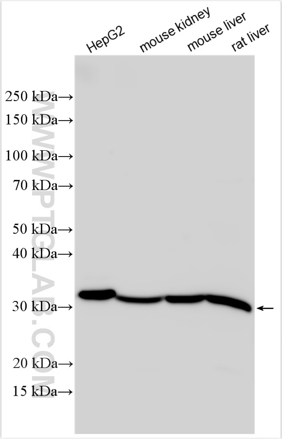 Western Blot (WB) analysis of various lysates using VAPA Polyclonal antibody (15275-1-AP)