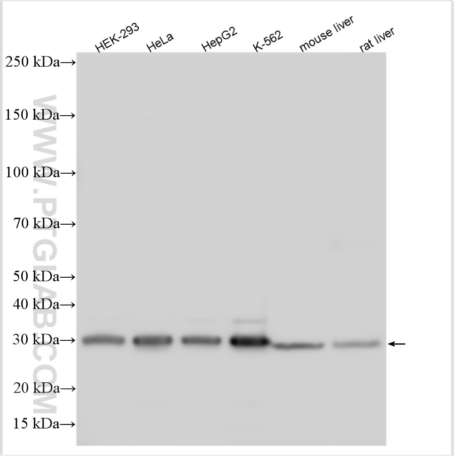 Western Blot (WB) analysis of various lysates using VAPA Polyclonal antibody (15275-1-AP)