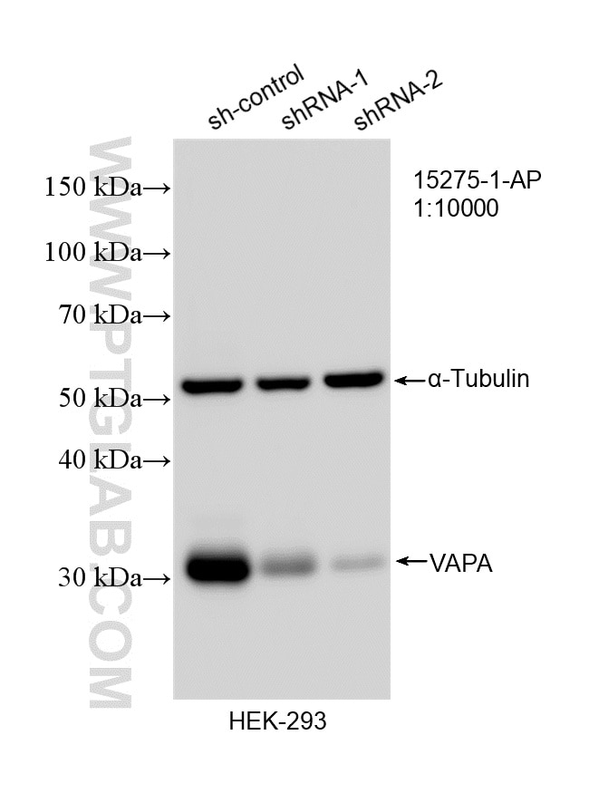 WB analysis of HEK-293 using 15275-1-AP Western Blot (WB) analysis of HEK-293 cells using VAPA Polyclonal antibody (15275-1-AP)