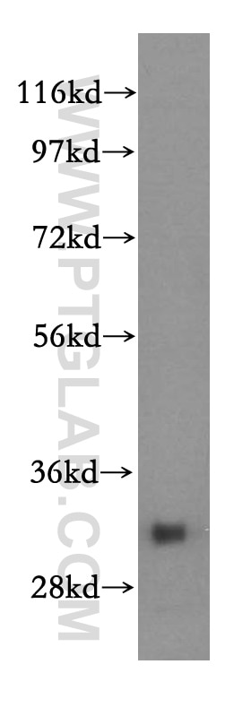 WB analysis of mouse skeletal muscle using 15275-1-AP