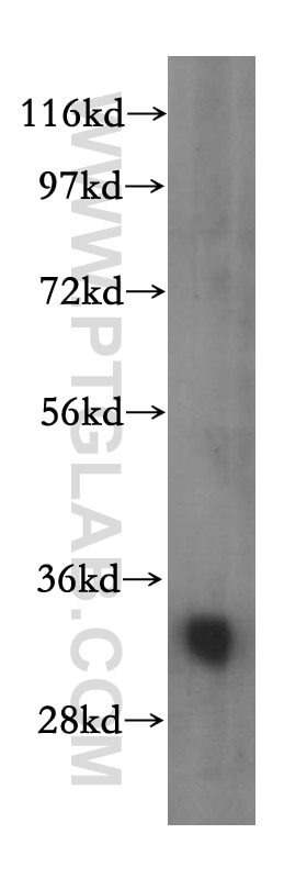 Western Blot (WB) analysis of human kidney tissue using VAPA Polyclonal antibody (15275-1-AP)