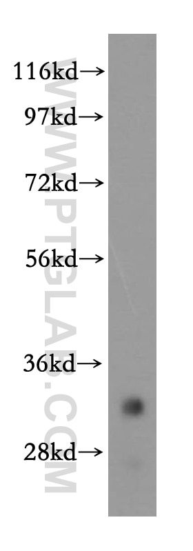 Western Blot (WB) analysis of human brain tissue using VAPA Polyclonal antibody (15275-1-AP)