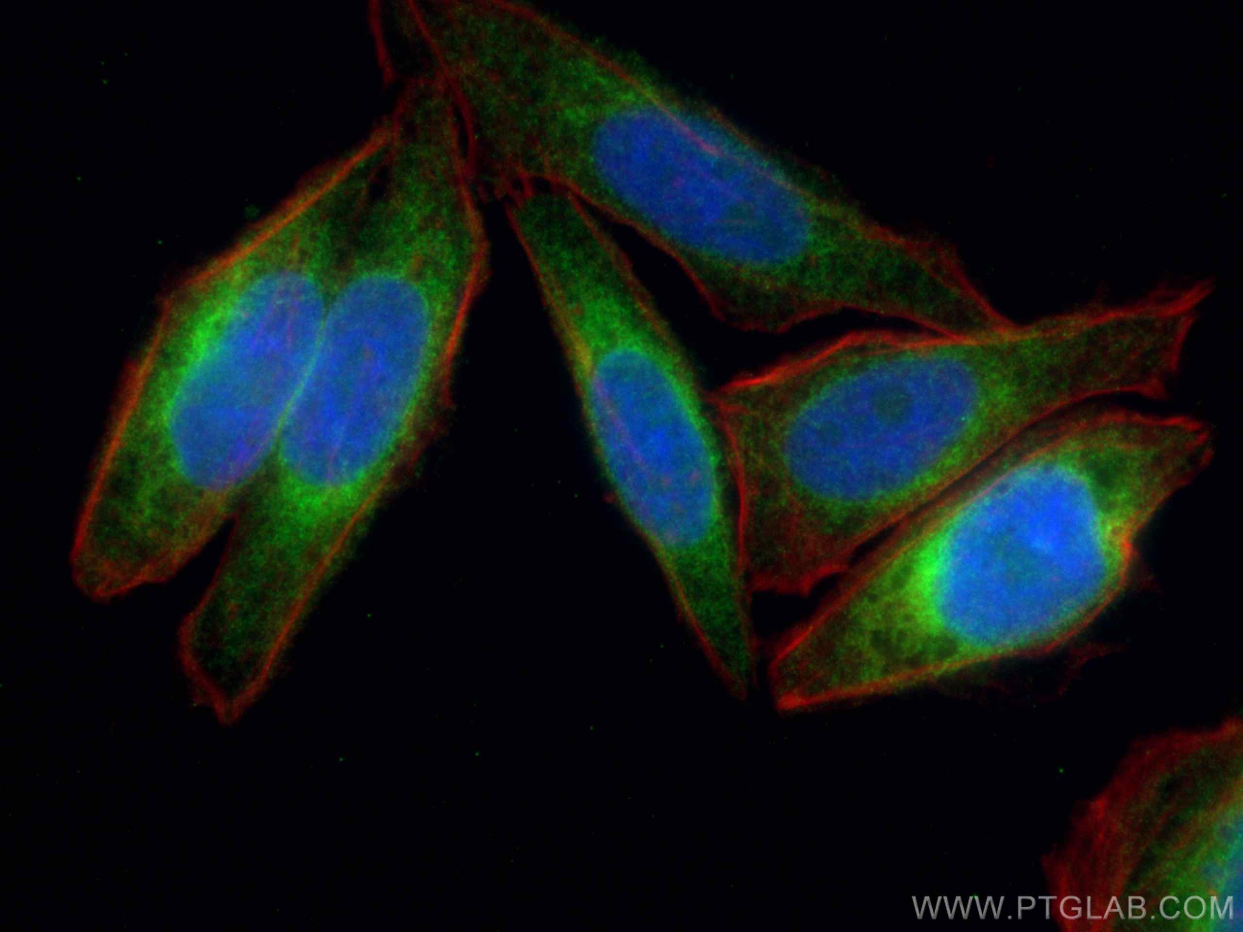Immunofluorescence (IF) / fluorescent staining of HepG2 cells using VAPB Polyclonal antibody (14477-1-AP)