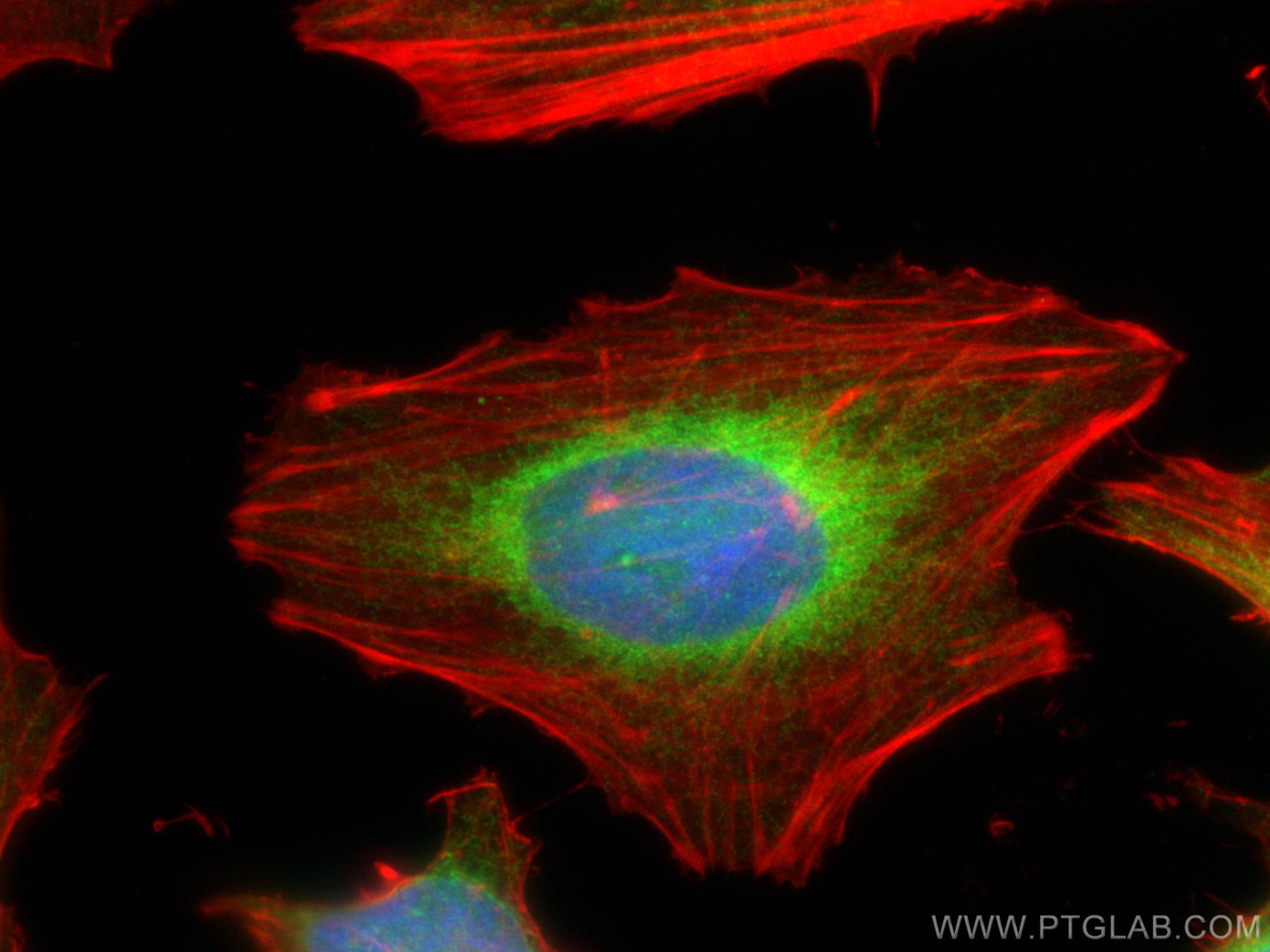 Immunofluorescence (IF) / fluorescent staining of HeLa cells using VAPB Polyclonal antibody (14477-1-AP)