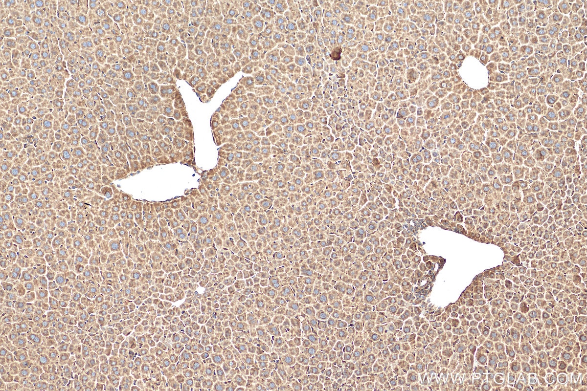 IHC staining of mouse liver using 14477-1-AP