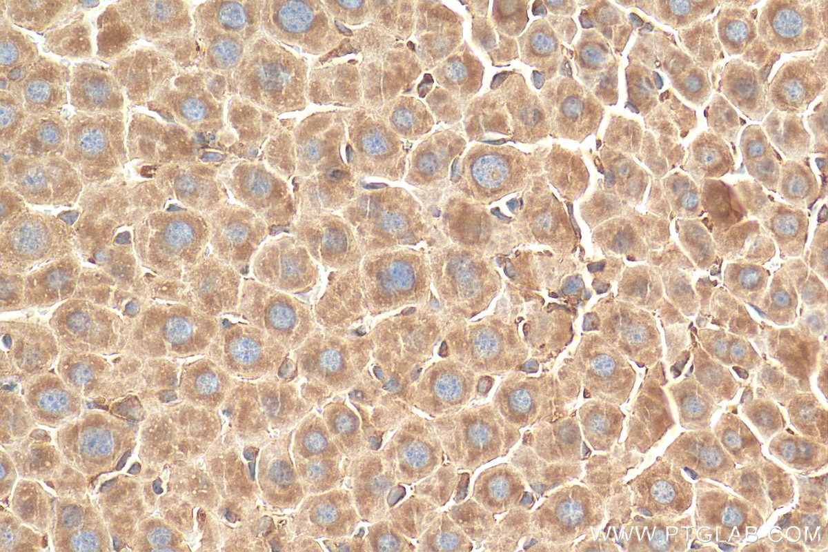 Immunohistochemistry (IHC) staining of mouse liver tissue using VAPB Polyclonal antibody (14477-1-AP)