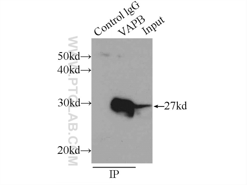 Immunoprecipitation (IP) experiment of HeLa cells using VAPB Polyclonal antibody (14477-1-AP)