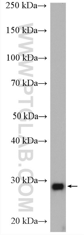 WB analysis of rat brain using 14477-1-AP