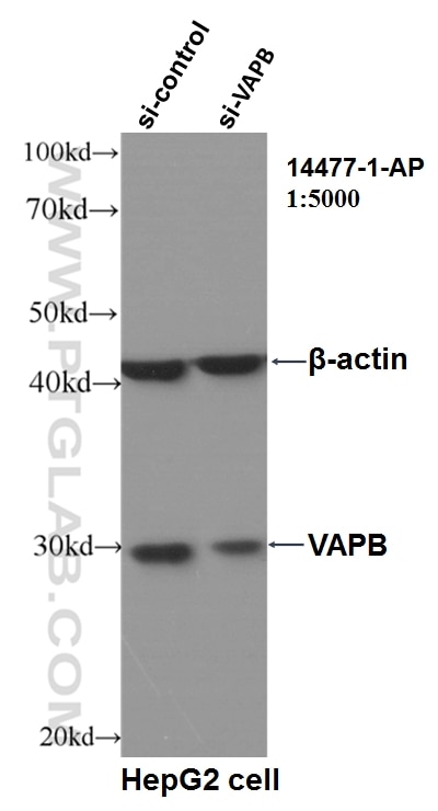 Western Blot (WB) analysis of HepG2 cells using VAPB Polyclonal antibody (14477-1-AP)