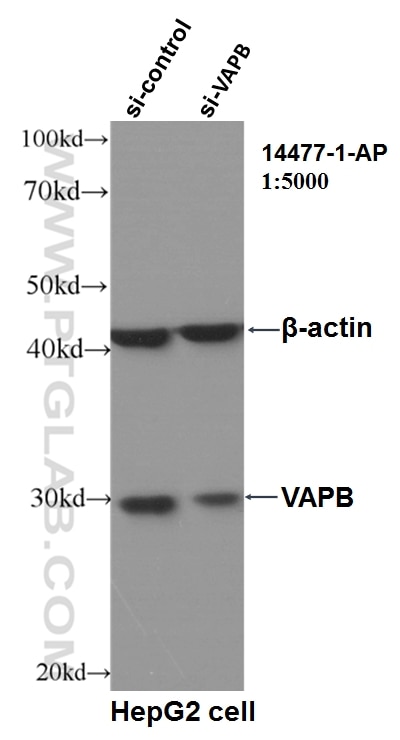 WB analysis of HepG2 using 14477-1-AP