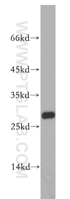Western Blot (WB) analysis of mouse skeletal muscle tissue using VAPB Polyclonal antibody (14477-1-AP)