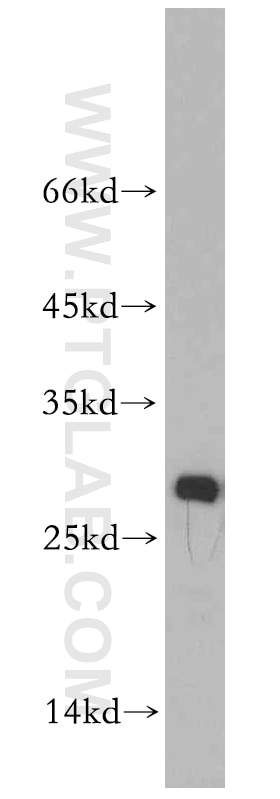 Western Blot (WB) analysis of HepG2 cells using VAPB Polyclonal antibody (14477-1-AP)