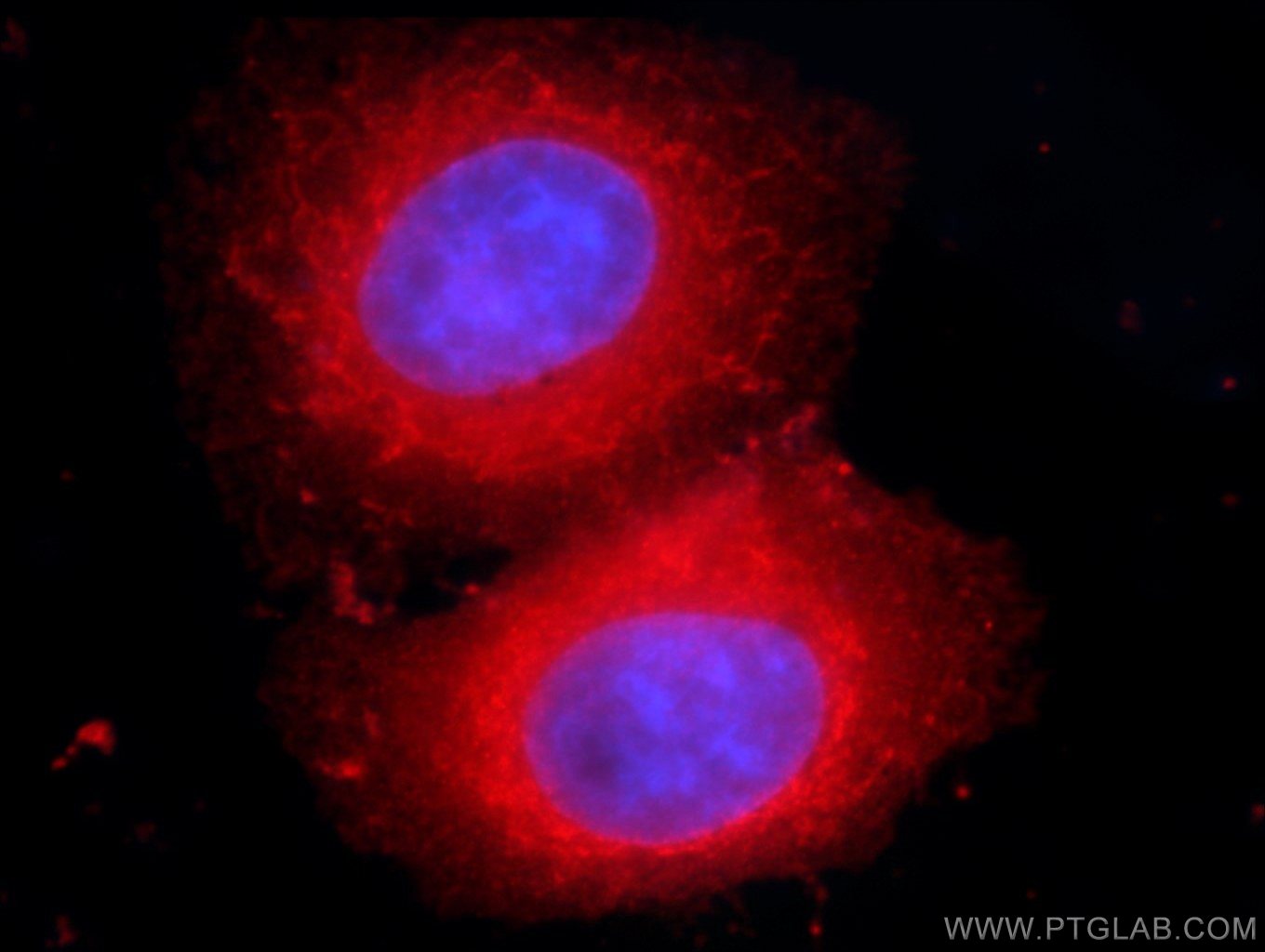 Immunofluorescence (IF) / fluorescent staining of HepG2 cells using VAPB Monoclonal antibody (66191-1-Ig)