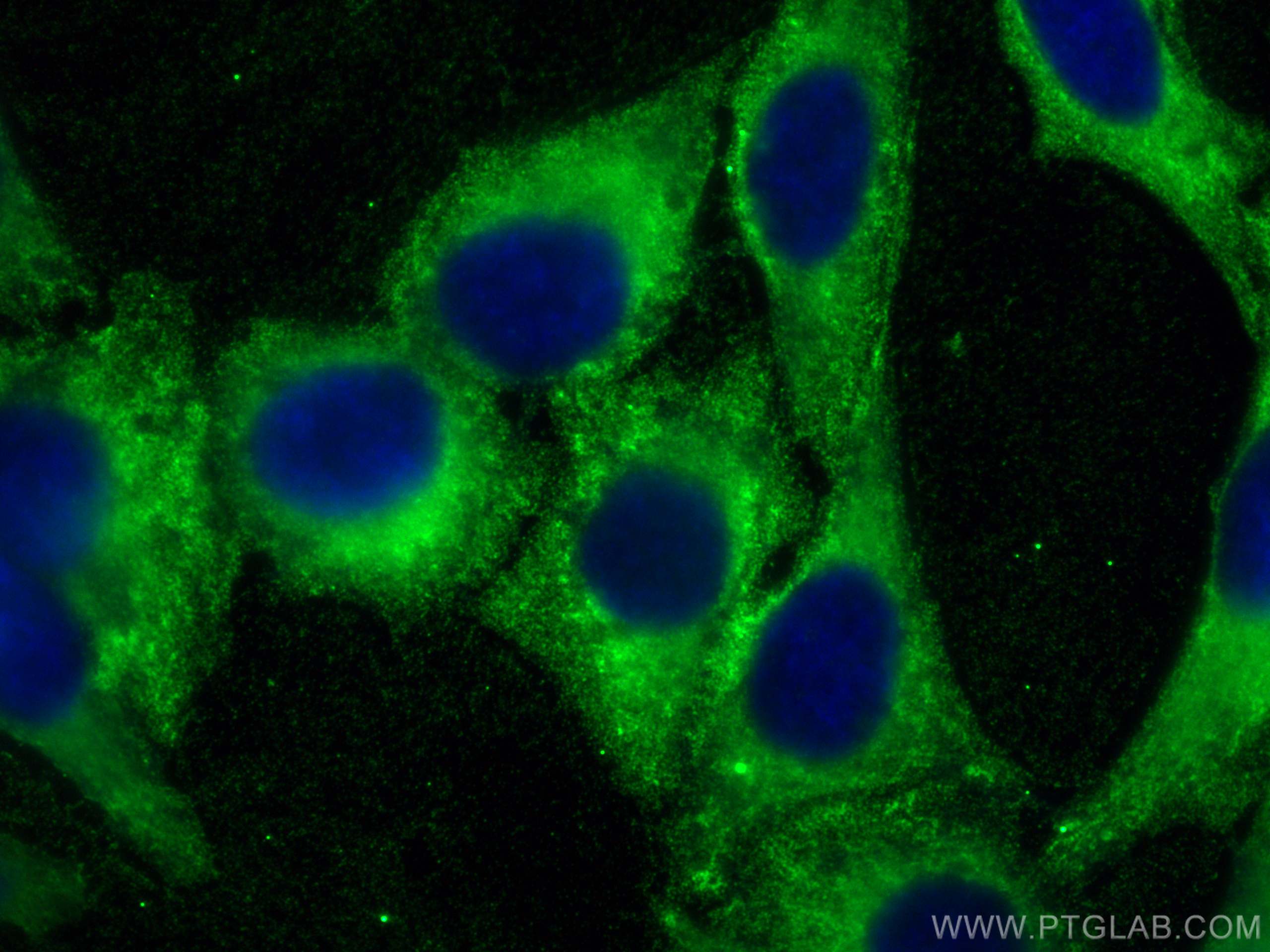 Immunofluorescence (IF) / fluorescent staining of HepG2 cells using VAPB Monoclonal antibody (66191-1-Ig)