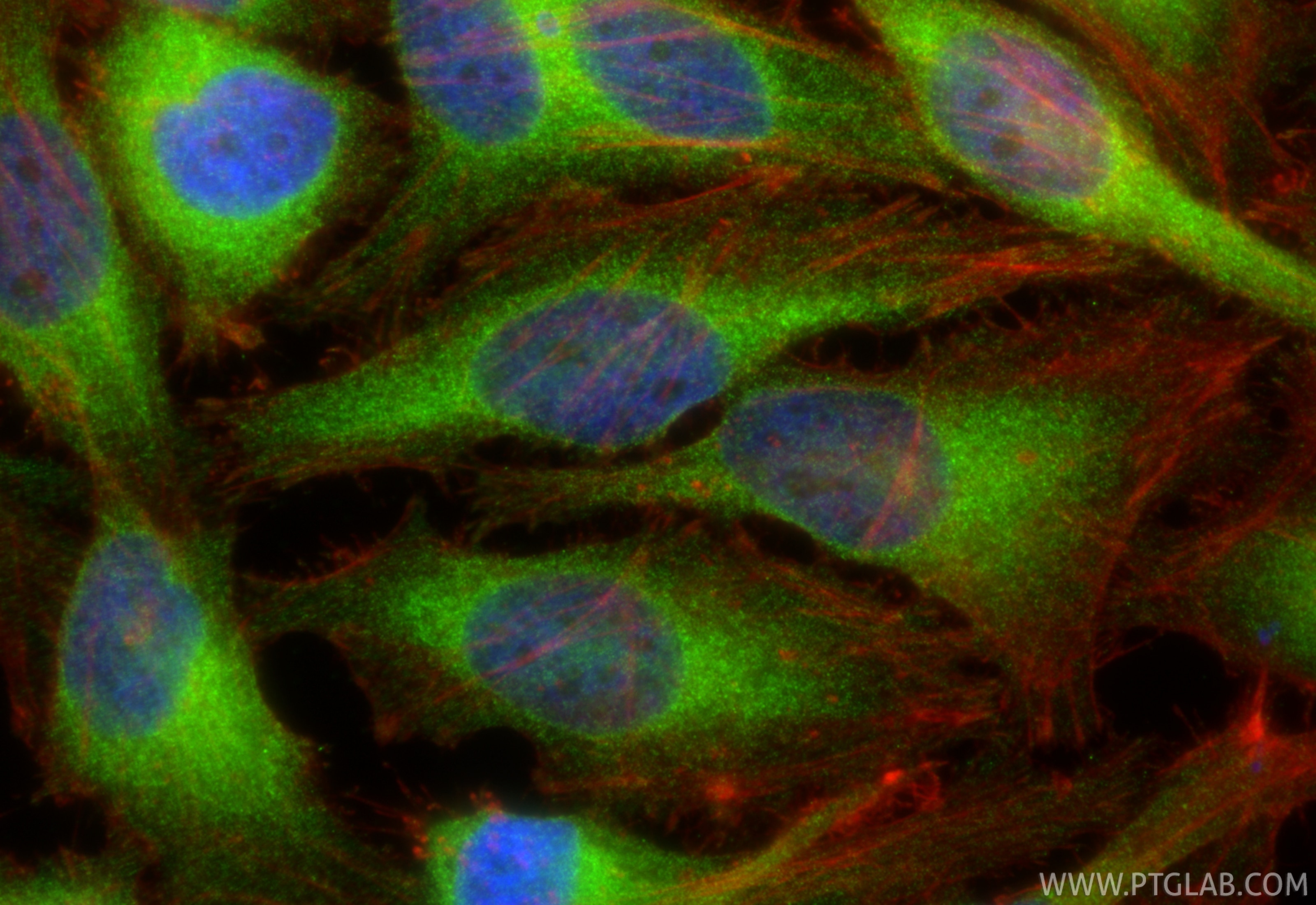 Immunofluorescence (IF) / fluorescent staining of HeLa cells using VAPB Monoclonal antibody (66191-1-Ig)