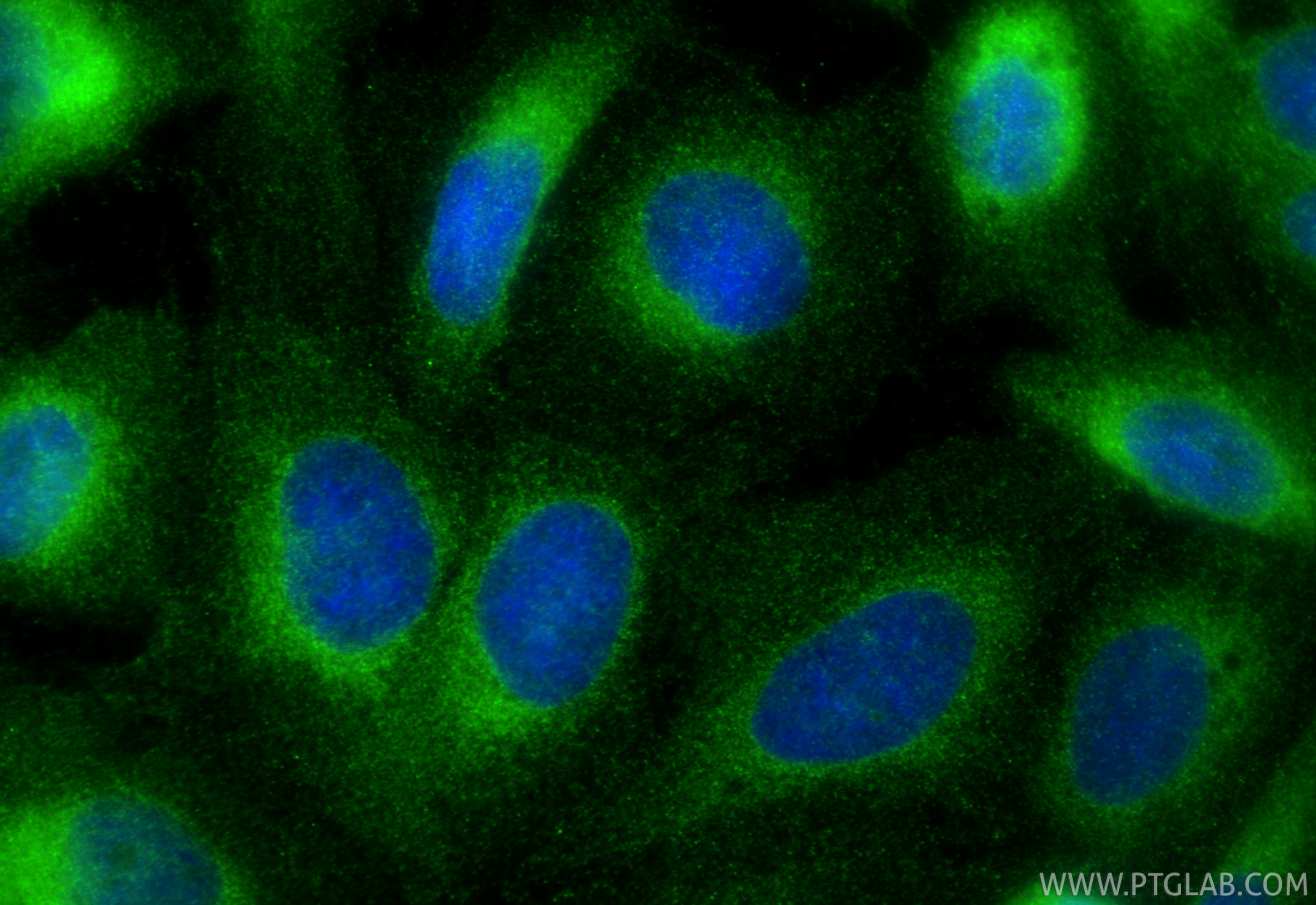 Immunofluorescence (IF) / fluorescent staining of U2OS cells using VAPB Monoclonal antibody (66191-1-Ig)