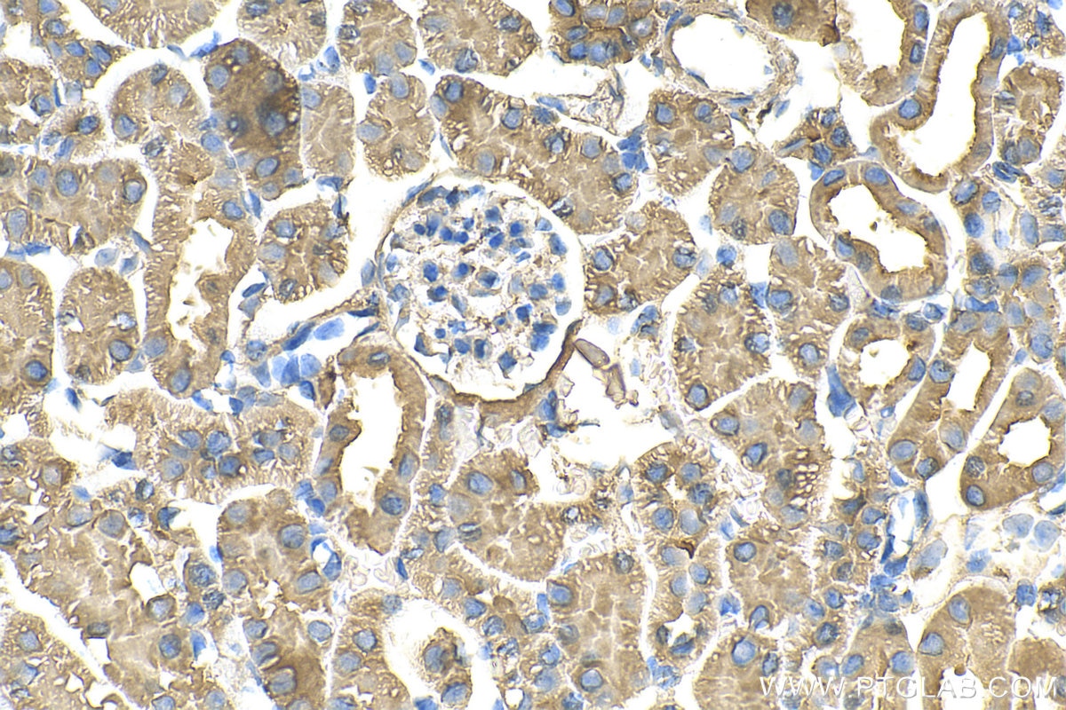 Immunohistochemistry (IHC) staining of mouse kidney tissue using VAPB Monoclonal antibody (66191-1-Ig)