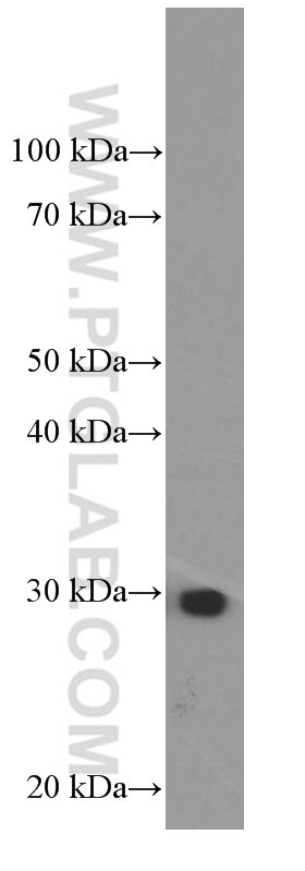 Western Blot (WB) analysis of Jurkat cells using VAPB Monoclonal antibody (66191-1-Ig)