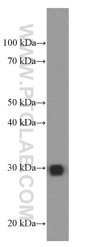 Western Blot (WB) analysis of HeLa cells using VAPB Monoclonal antibody (66191-1-Ig)