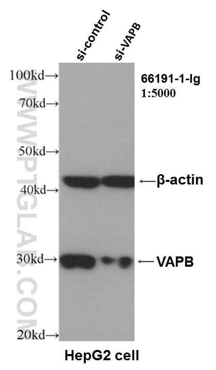 Western Blot (WB) analysis of HepG2 cells using VAPB Monoclonal antibody (66191-1-Ig)