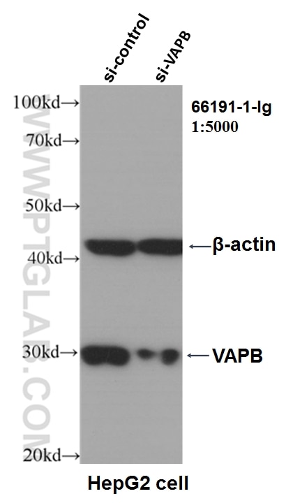 WB analysis of HepG2 using 66191-1-Ig