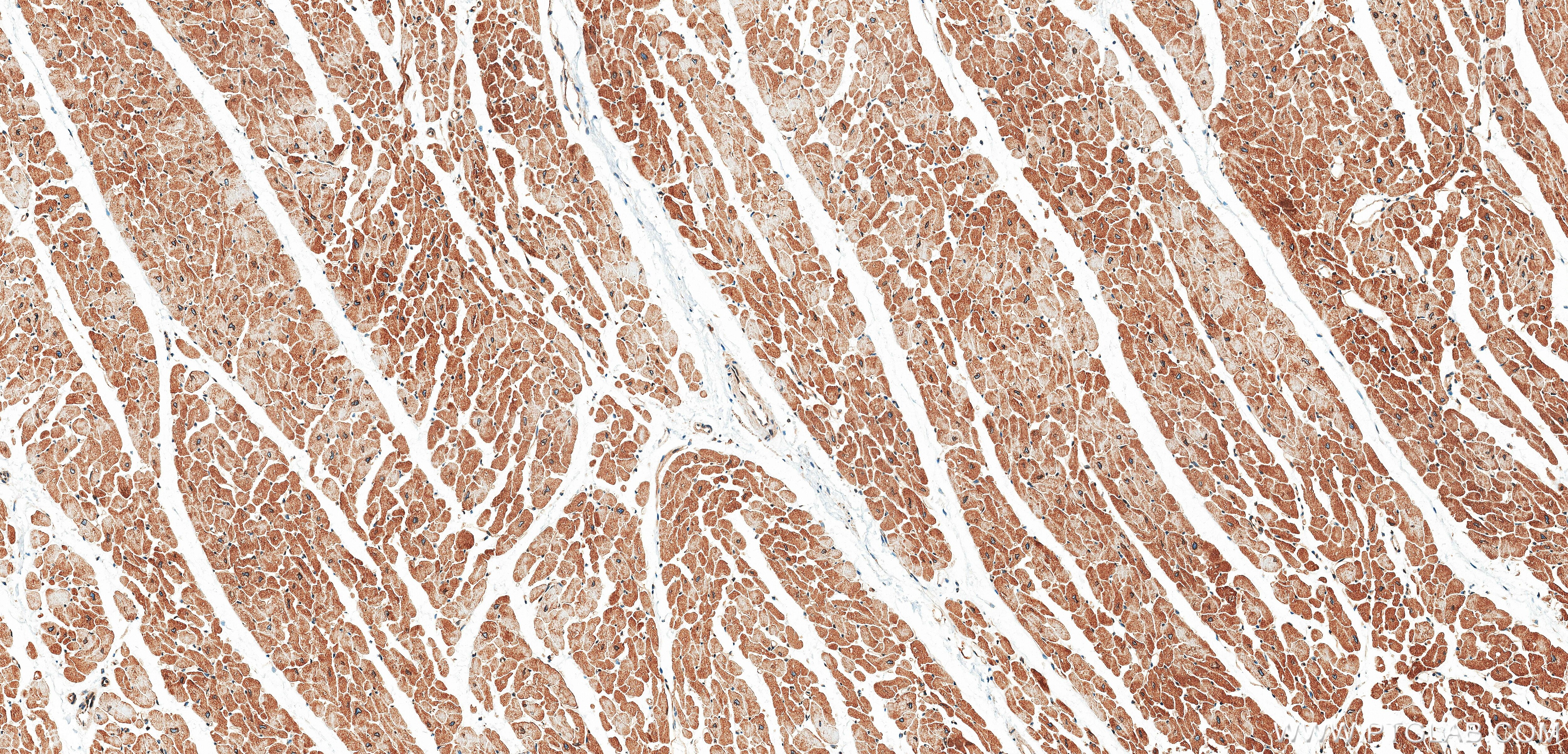 IHC staining of human heart using 87770-3-RR Immunohistochemistry (IHC) staining of human heart tissue using VAPB Recombinant monoclonal antibody (87770-3-RR)