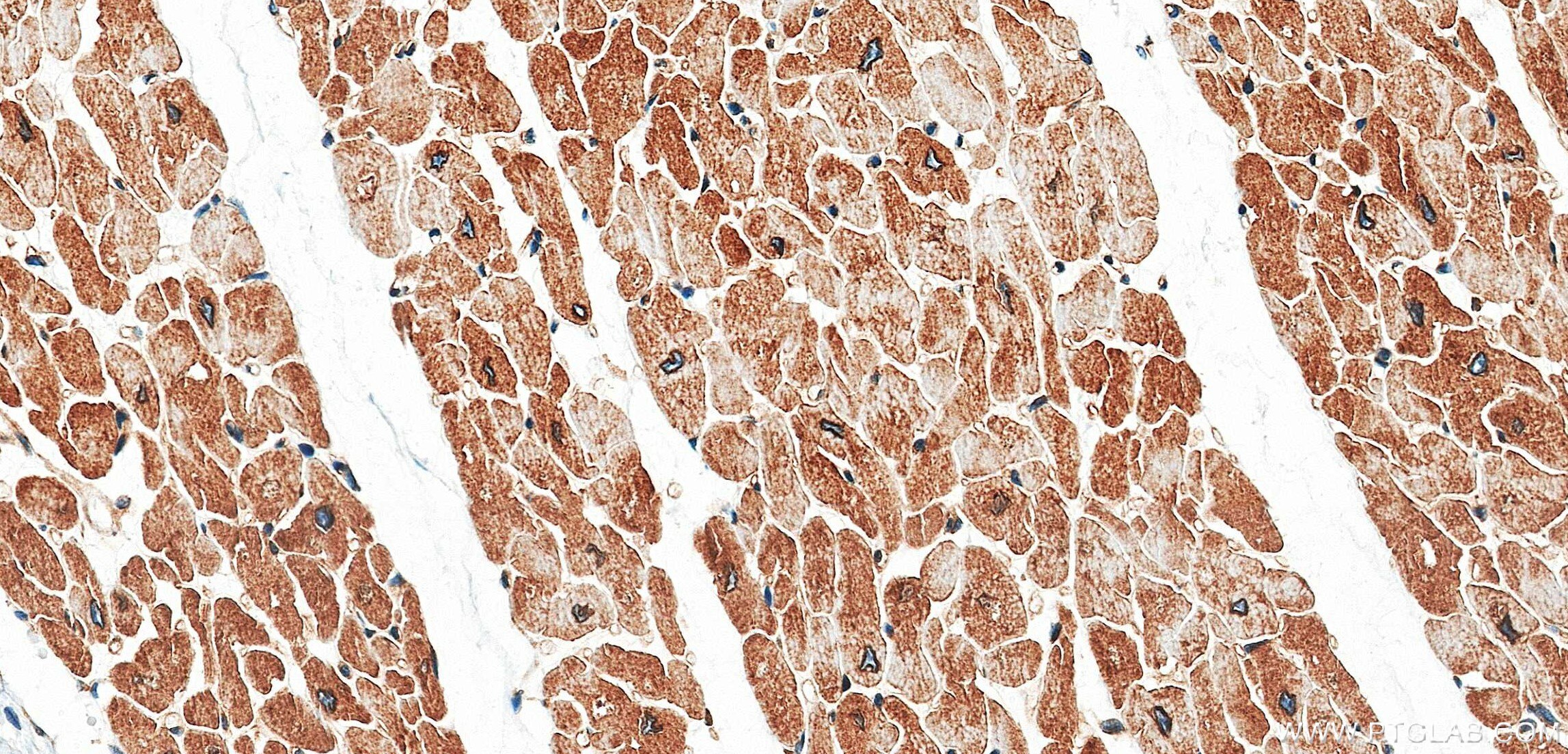 IHC staining of human heart using 87770-3-RR Immunohistochemistry (IHC) staining of human heart tissue using VAPB Recombinant monoclonal antibody (87770-3-RR)