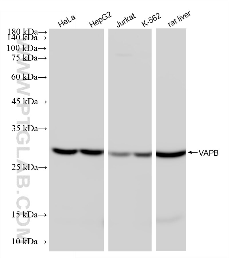 WB analysis using 87770-3-RR Western Blot (WB) analysis of various lysates using VAPB Recombinant monoclonal antibody (87770-3-RR)