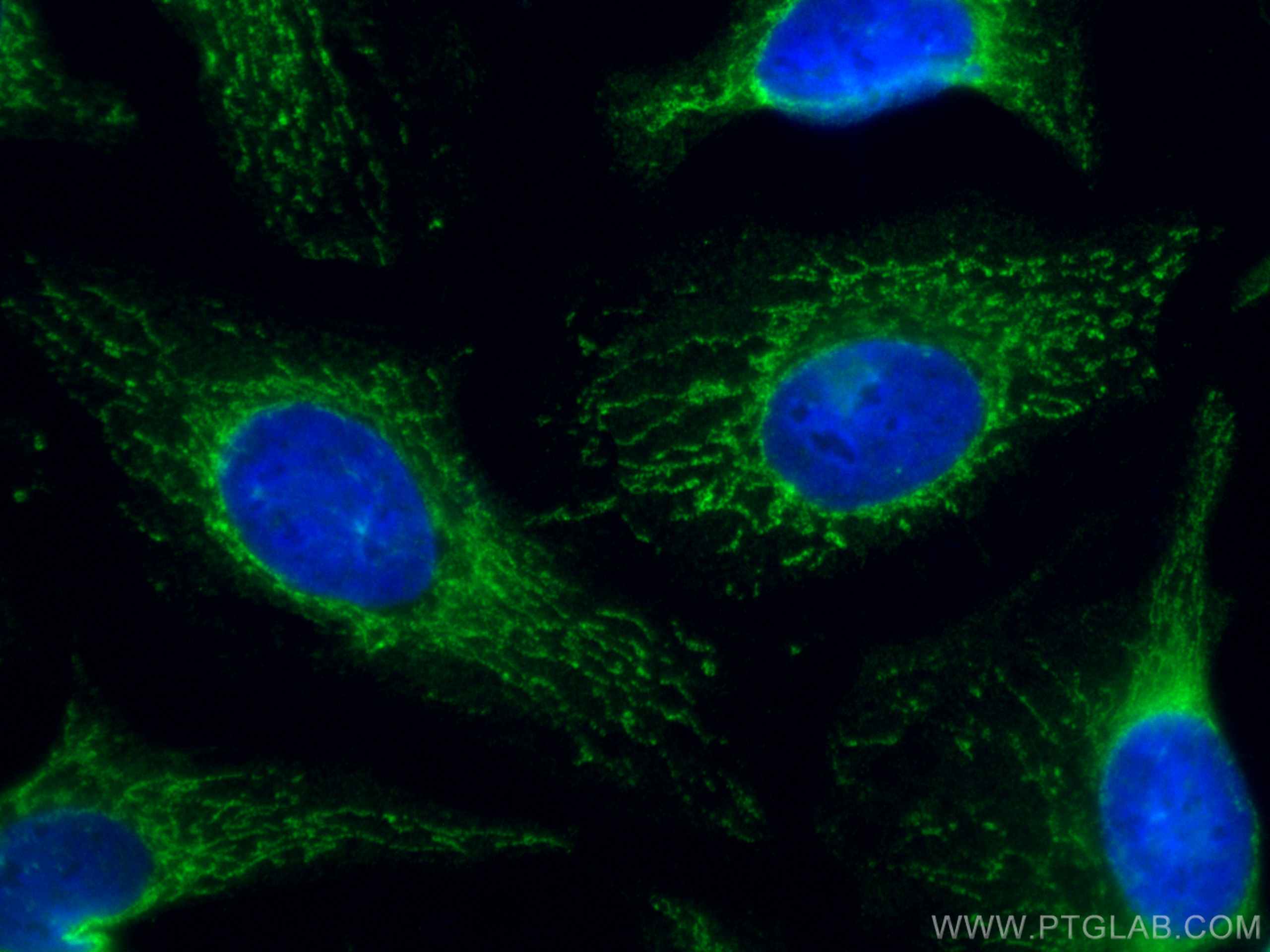 Immunofluorescence (IF) / fluorescent staining of HepG2 cells using CoraLite® Plus 488-conjugated VAPB Monoclonal anti (CL488-66191)