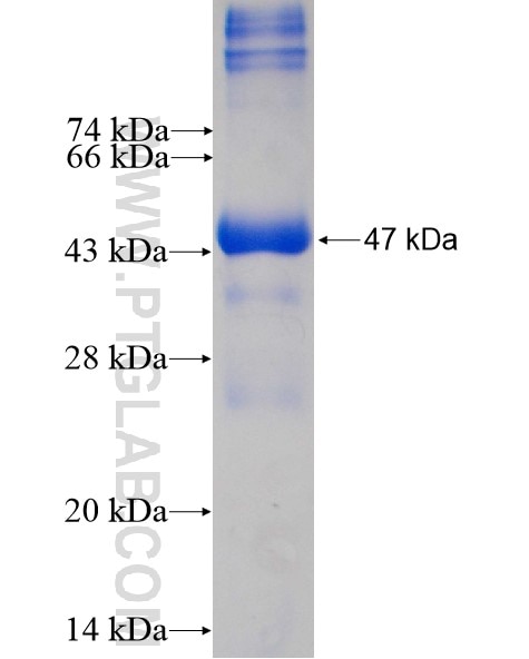 VAPB fusion protein Ag5857 SDS-PAGE