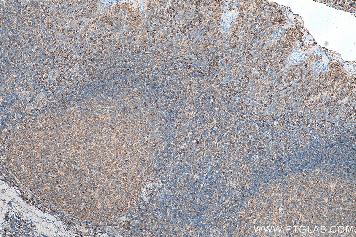 Immunohistochemistry (IHC) staining of human tonsillitis tissue using ValRS Polyclonal antibody (15931-1-AP)