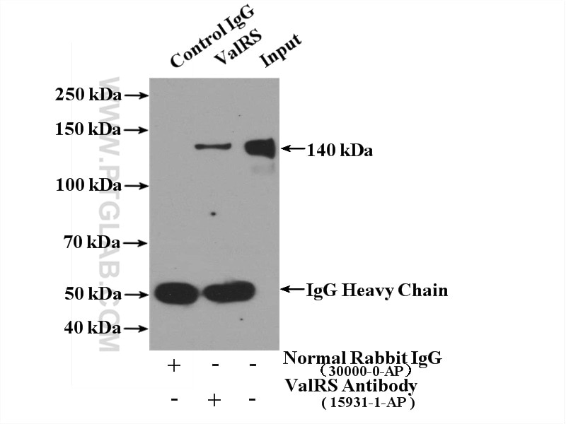 Immunoprecipitation (IP) experiment of HL-60 cells using ValRS Polyclonal antibody (15931-1-AP)