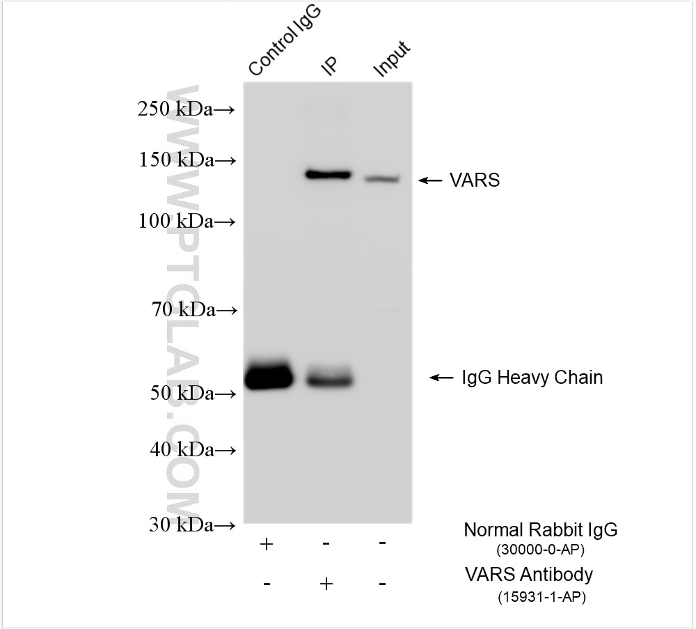 Immunoprecipitation (IP) experiment of HeLa cells using ValRS Polyclonal antibody (15931-1-AP)