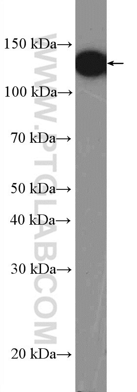 Western Blot (WB) analysis of HL-60 cells using ValRS Polyclonal antibody (15931-1-AP)