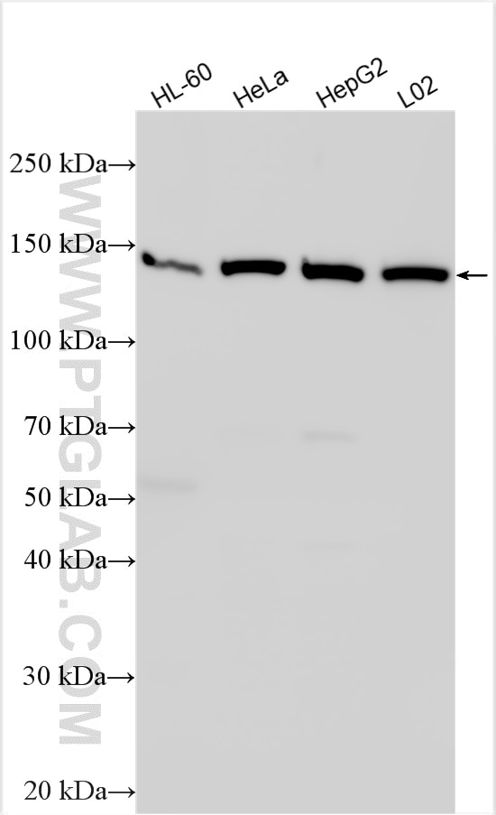 Western Blot (WB) analysis of various lysates using ValRS Polyclonal antibody (15931-1-AP)