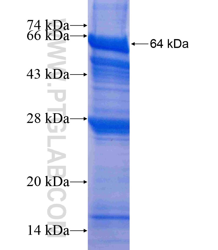 VARS fusion protein Ag8778 SDS-PAGE