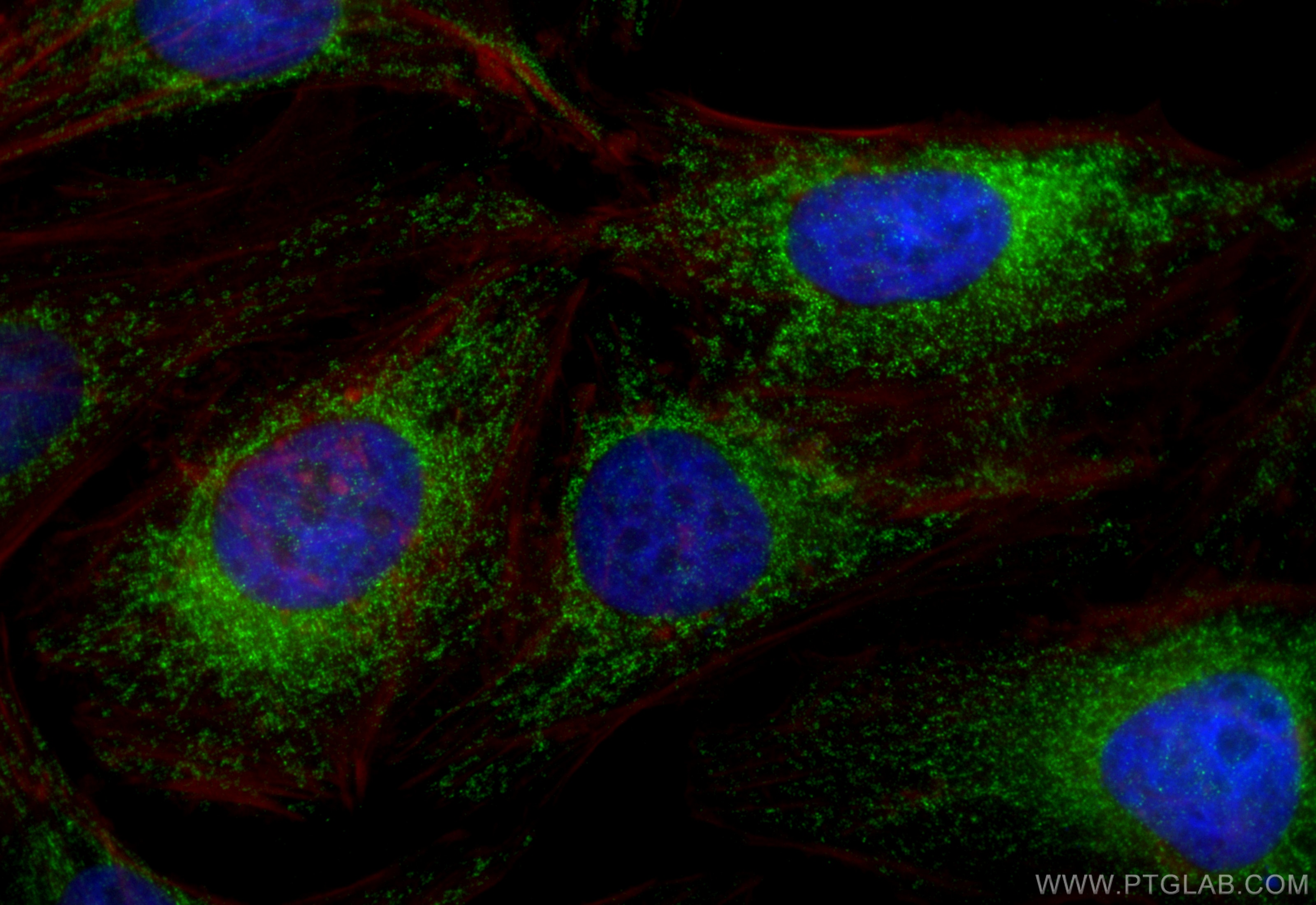 Immunofluorescence (IF) / fluorescent staining of HeLa cells using VARS2 Polyclonal antibody (15776-1-AP)