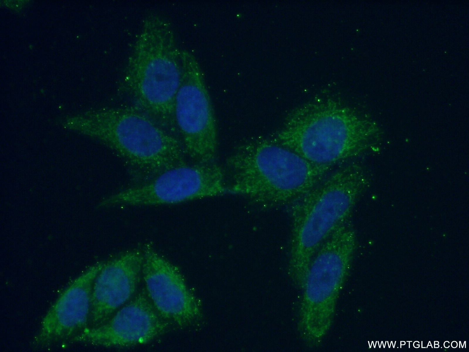 Immunofluorescence (IF) / fluorescent staining of HeLa cells using VARS2 Polyclonal antibody (15776-1-AP)